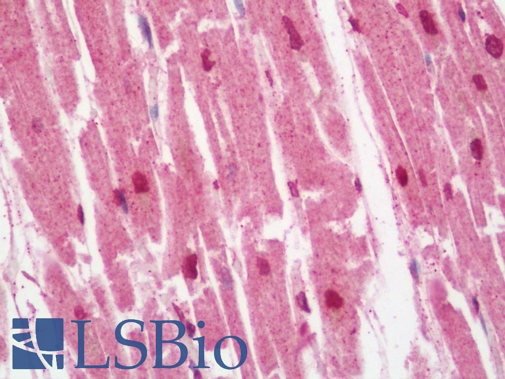 IHC-plus™ Polyclonal Rabbit anti-Human NOX3 Antibody (IHC, IF, WB)