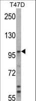 Polyclonal Rabbit anti-Human E6AP / UBE3A Antibody (aa836-865, IHC, IF, WB)