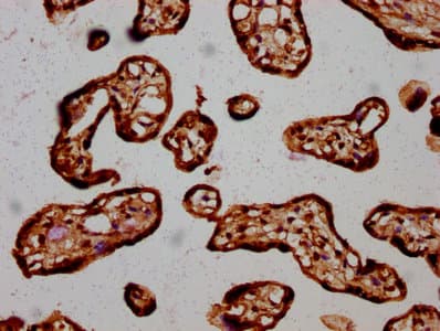 Polyclonal Rabbit anti-Human HIST1H3A Antibody (IHC, WB)
