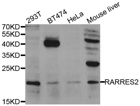 RARRES2 / Chemerin Antibody