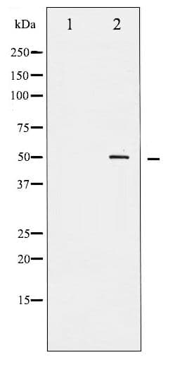 Polyclonal Rabbit anti-Human AML1 / RUNX1 Antibody (phospho-Ser303, IHC, WB)