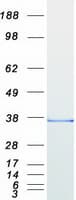 Human SLIM / FHL1 Protein (Recombinant Myc-DDK (Flag))