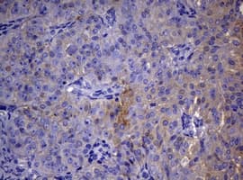 Monoclonal Mouse anti-Human TS / Thymidylate Synthase Antibody (clone 10F12, Carrier-free, IHC, WB)