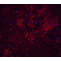 IHC-plus™ Polyclonal Rabbit anti-Human LCX / TET1 Antibody (IHC, IF, WB)