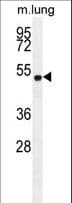 ELL / MEN Antibody (aa516-545)