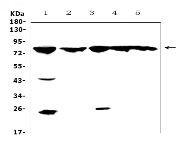 ADRBK1 / GRK2 Antibody