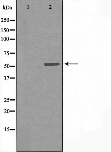 CYP7B1 Antibody
