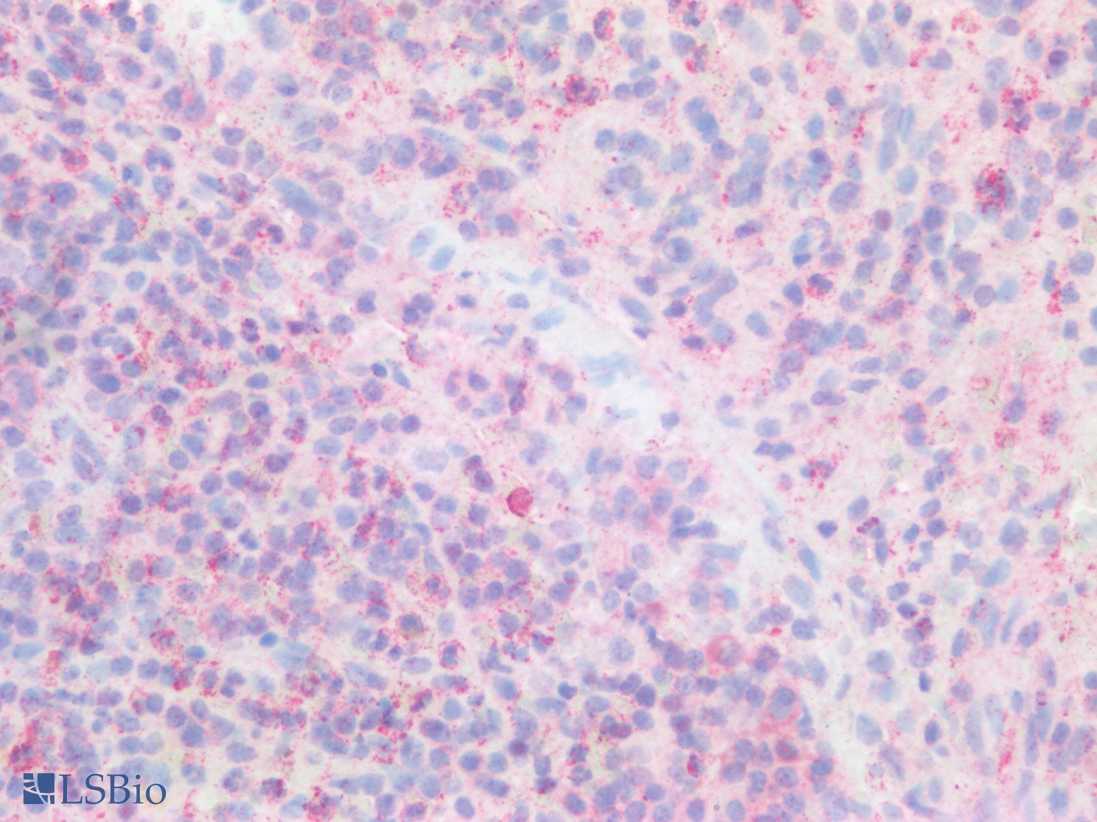 DGKA Antibody (aa305-531)