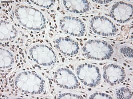 VEGFA / VEGF Antibody (clone OTI2F7)