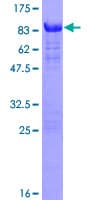 Human PALM2 Protein (Recombinant GST)
