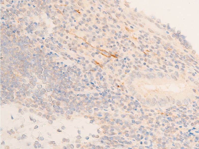 HSPB6 / HSP20 Antibody (phospho-Ser16)