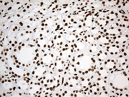 Monoclonal Mouse anti-Human IRF2BP1 Antibody (clone OTI3A6, Carrier-free, aa457-584, IHC, WB)
