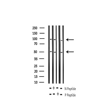 NFKB1 / NF-Kappa-B Antibody (phospho-Ser337)
