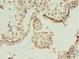 GGPS1 Antibody (aa1-300)