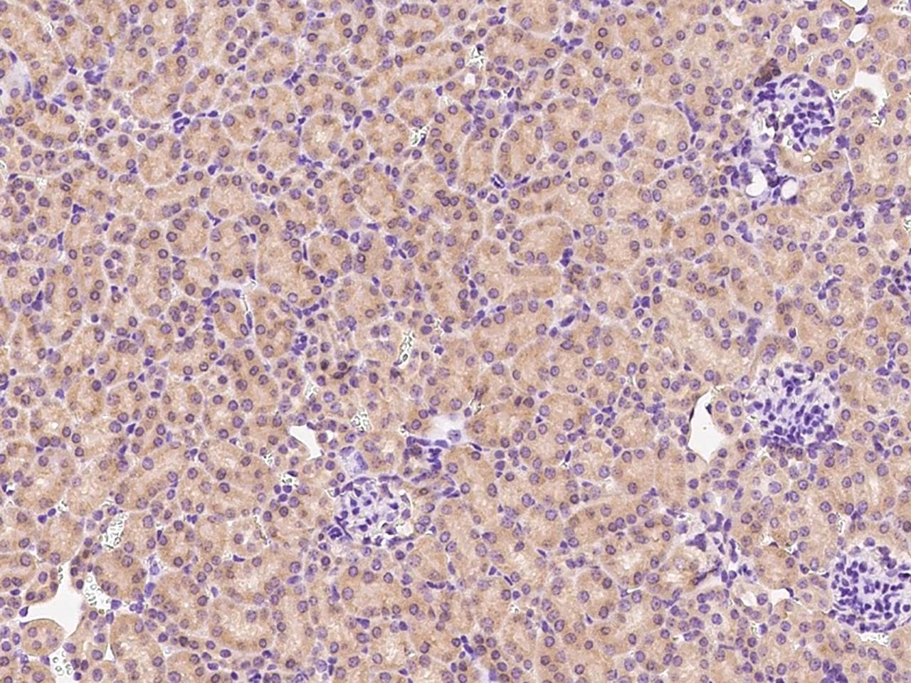 Polyclonal Rabbit anti-Mouse MIA40 / CHCHD4 Antibody (Preservative Free, IHC)