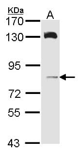 HPS6 Antibody (aa405-496)