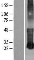 KRTCAP3 Protein (Over-Expression Lysate Myc-DDK (Flag))