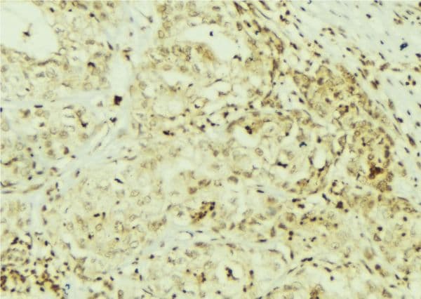 Polyclonal Rabbit anti-Human SRC Antibody (phospho-Ser75, IHC, IF, WB)