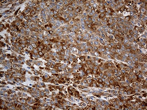 Monoclonal Mouse anti-Human GIPC1 / GIPC Antibody (clone OTI5C10, IHC, WB)