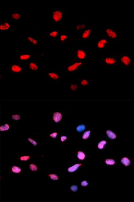 RB1 / Retinoblastoma / RB Antibody (phospho-Ser811)