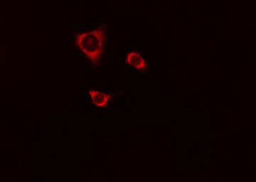 IHC-plus™ CSTA / Cystatin A Antibody
