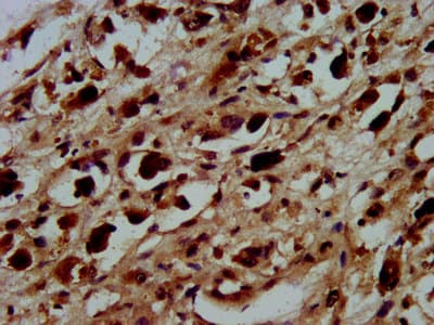 Polyclonal Rabbit anti-Human HIST1H3A Antibody (IHC, IF, WB)