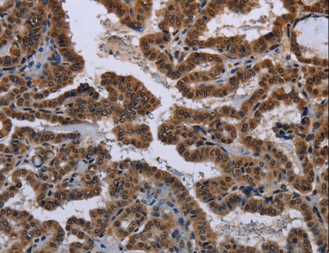 MYCN / N-myc Antibody