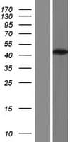 POLB / DNA Polymerase Beta Protein (Over-Expression Lysate Myc-DDK (Flag))