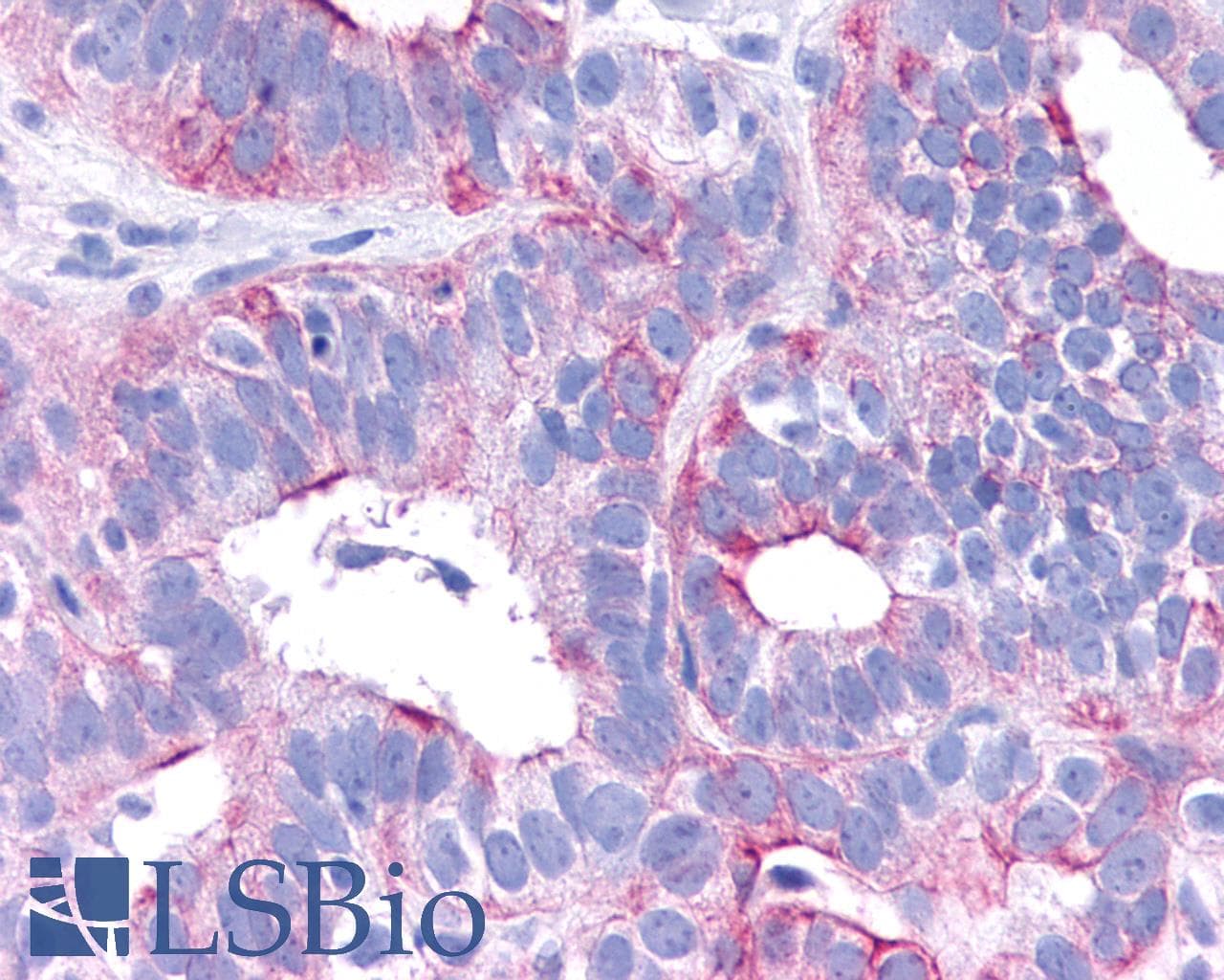 PathPlus™ VPAC2 / VIPR2 Antibody (C-Terminus)