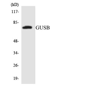 IHC-plus™ Polyclonal Rabbit anti-Human GUSB / Beta Glucuronidase Antibody (aa310-359, IHC, WB)