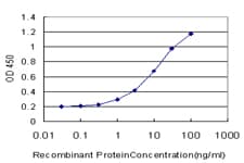 RAD1 Antibody (clone 1G2)
