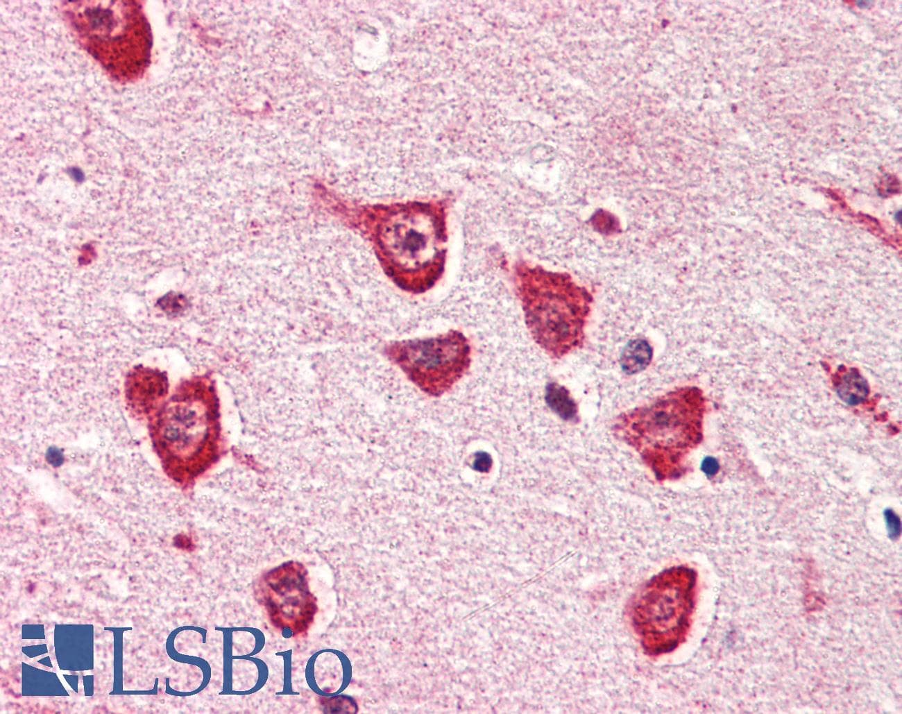 IHC-plus™ PPM1G Antibody (aa317-546, clone K1G6)