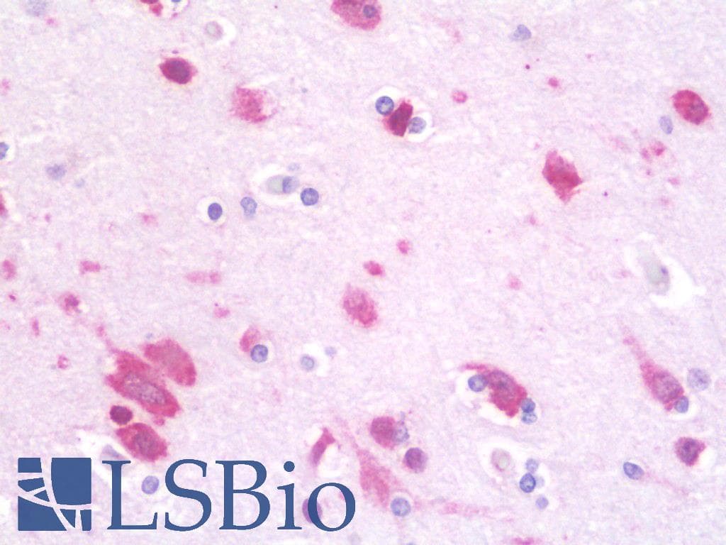 IHC-plus™ Polyclonal Rabbit anti-Human DHX36 Antibody (IHC, WB)