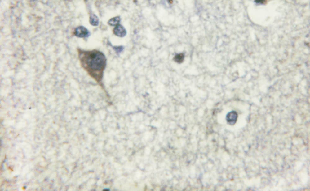 ADD1 / Adducin Alpha Antibody