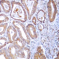 MRPL24 Antibody (Internal)