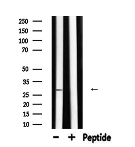 Polyclonal Rabbit anti-Human CA2 / Carbonic Anhydrase II Antibody (IHC, WB)