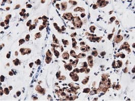 AK5 / Adenylate Kinase 5 Antibody (clone OTI2F9)