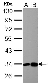 Polyclonal Rabbit anti-Human HIBADH Antibody (IHC, WB)