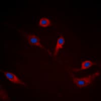 Polyclonal Rabbit anti-Human SNCA / Alpha-Synuclein Antibody (C-Terminus, IHC, IF, WB)