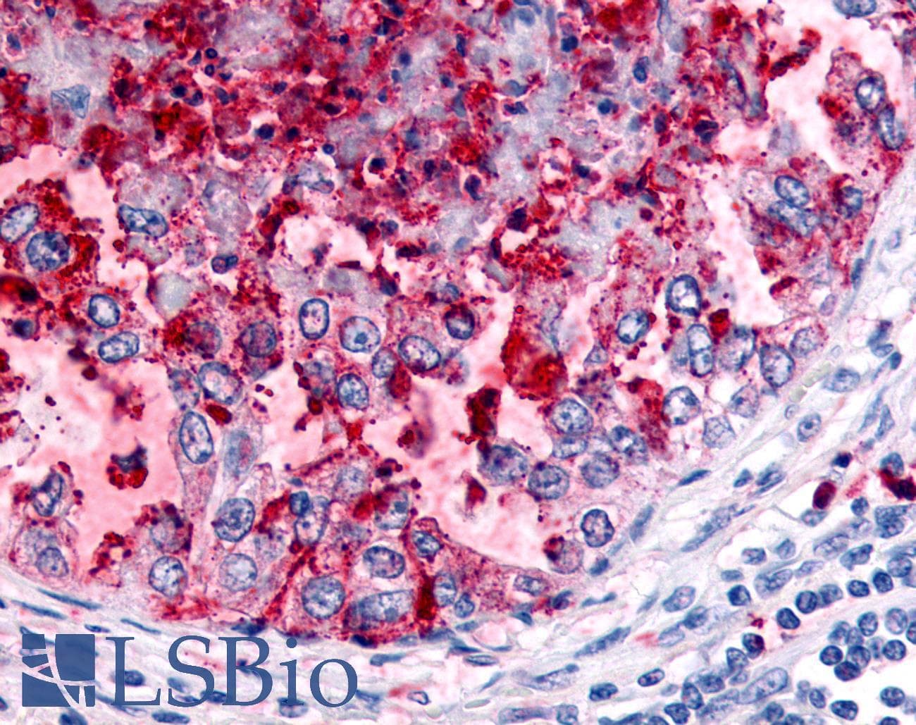 PathPlus™ Polyclonal Rabbit anti-Human WNK1 Antibody (Internal, IHC)