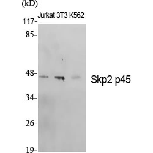 SKP2 Antibody (340-420 aa, C-terminal)