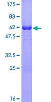 Human DUSP12 Protein (Recombinant GST)