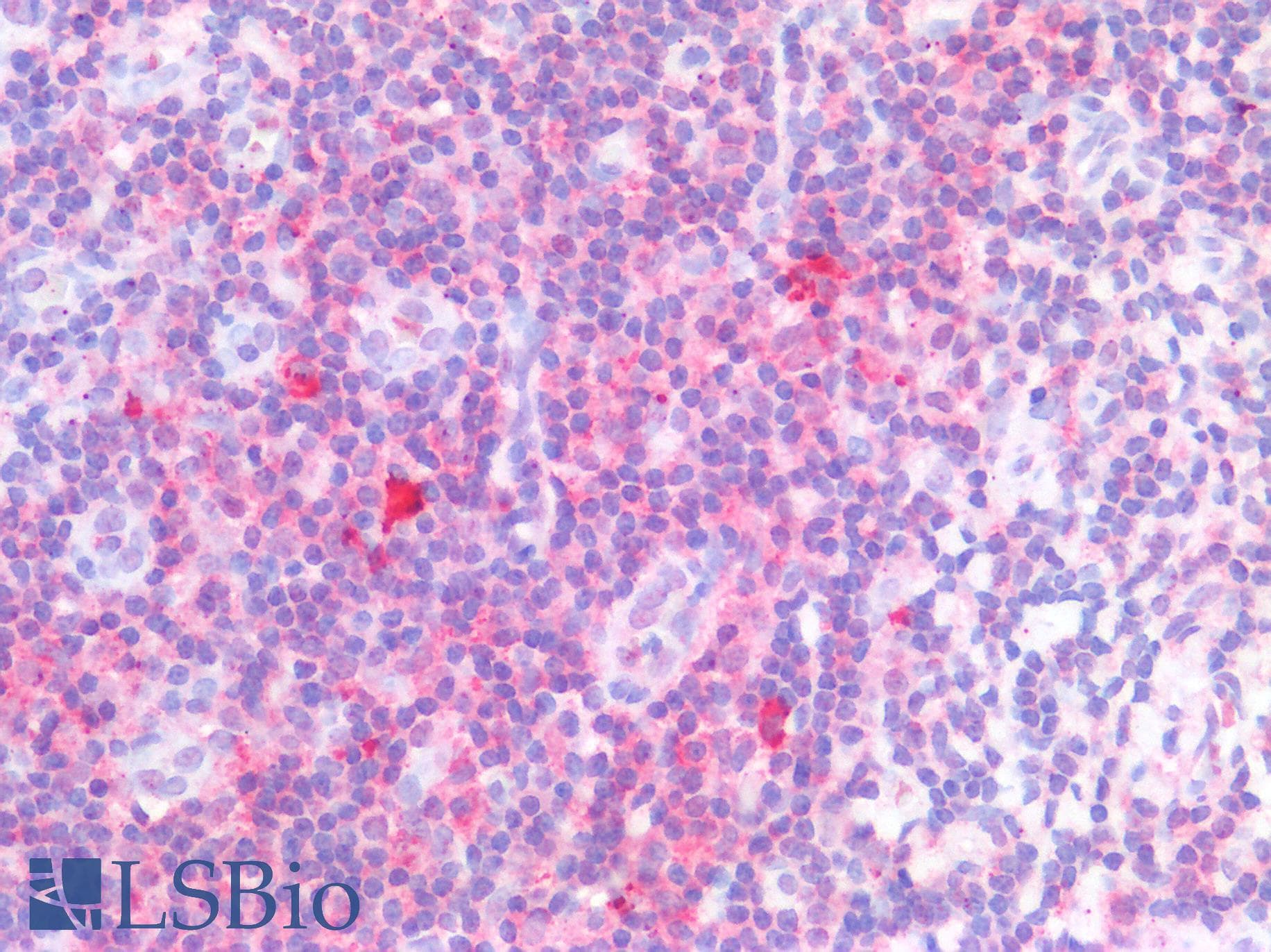 IHC-plus™ TLR8 Antibody