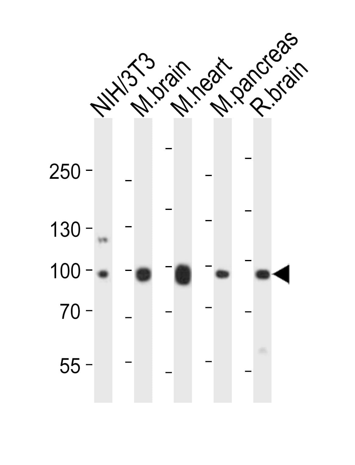 EPHB1 / EPH Receptor B1 Antibody (aa304-339)