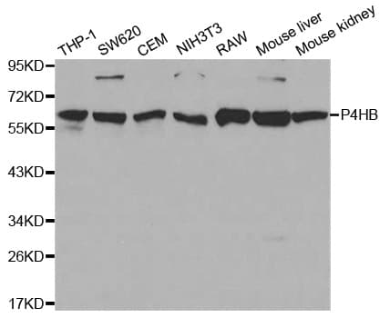 IHC-plus™ PDI / P4HB Antibody