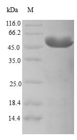 Human CENPK Protein (Recombinant GST, N-terminus)