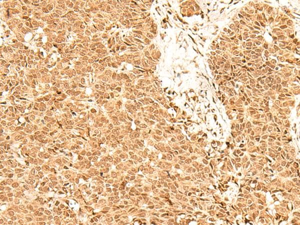 ADRM1 Antibody