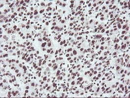 NONO / P54NRB Antibody (clone OTI2C9)