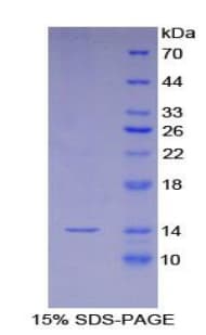 Human Beta Lipotropin Protein (Recombinant His-T7)