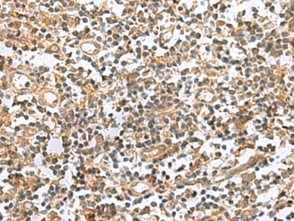 HHIPL2 Antibody